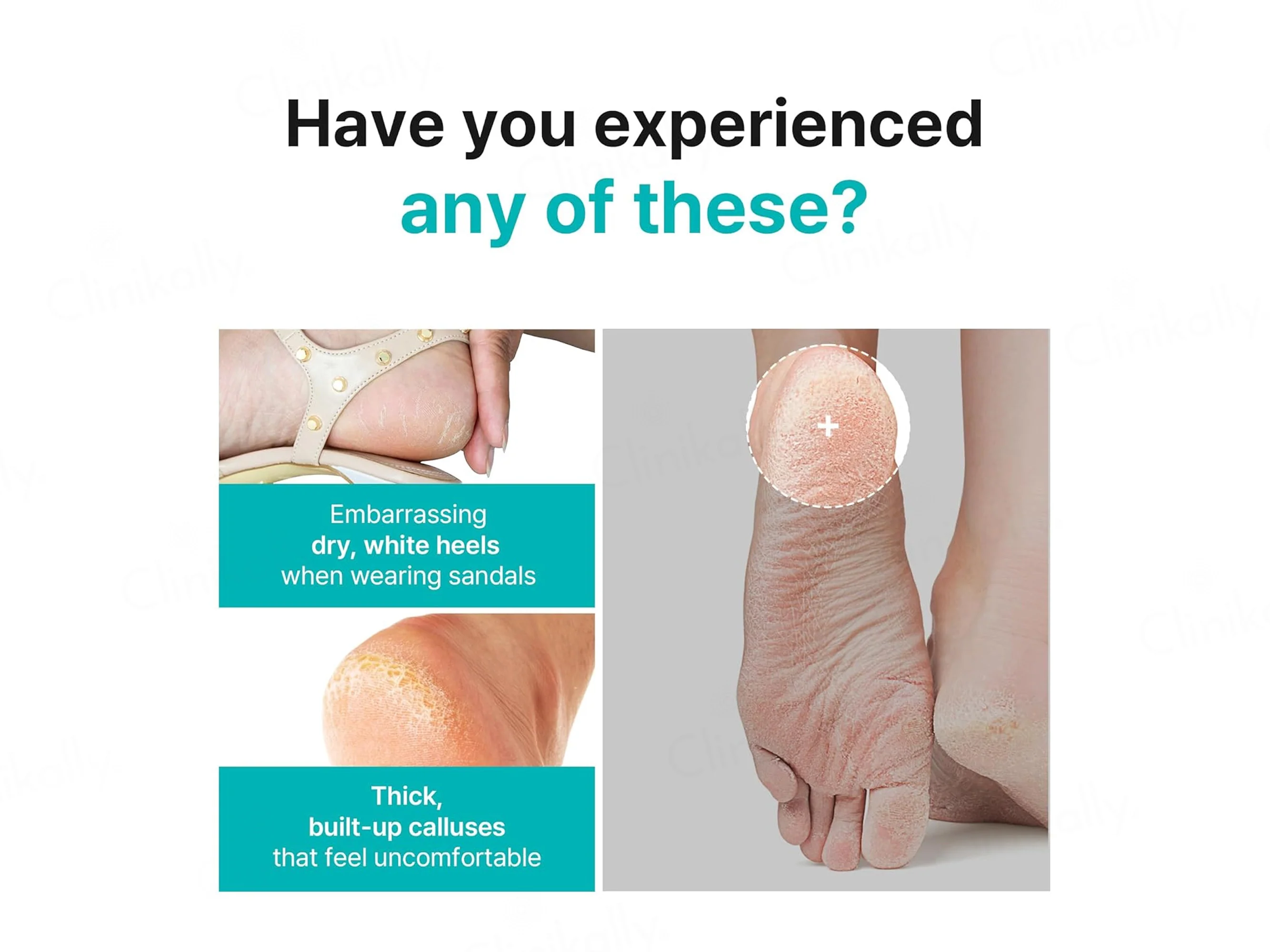 Ariul Smooth & Pure Lemon Extract Foot Peeling Mask - Image 3