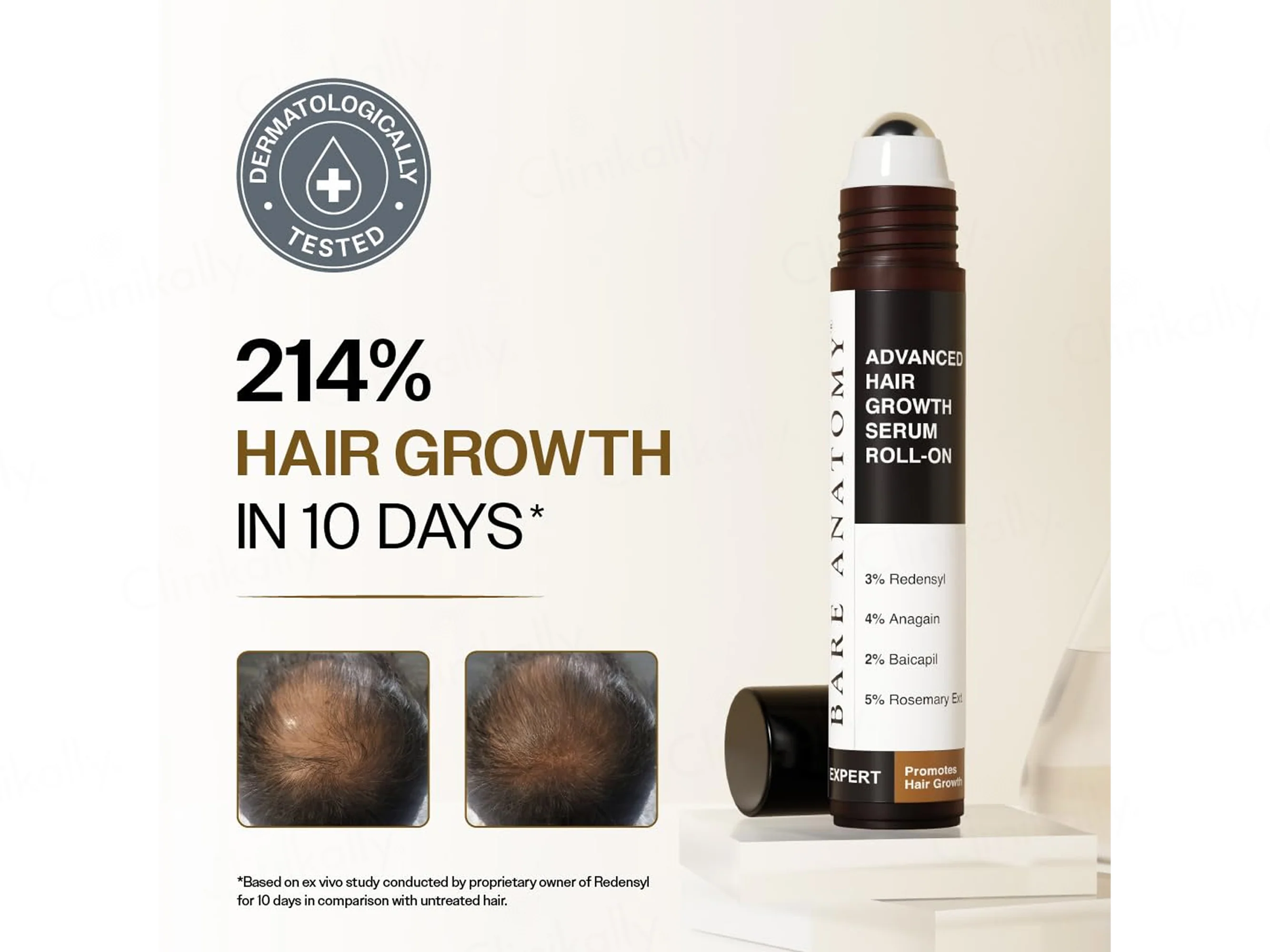 Bare Anatomy Advanced Hair Growth Serum Roll-On - Image 2