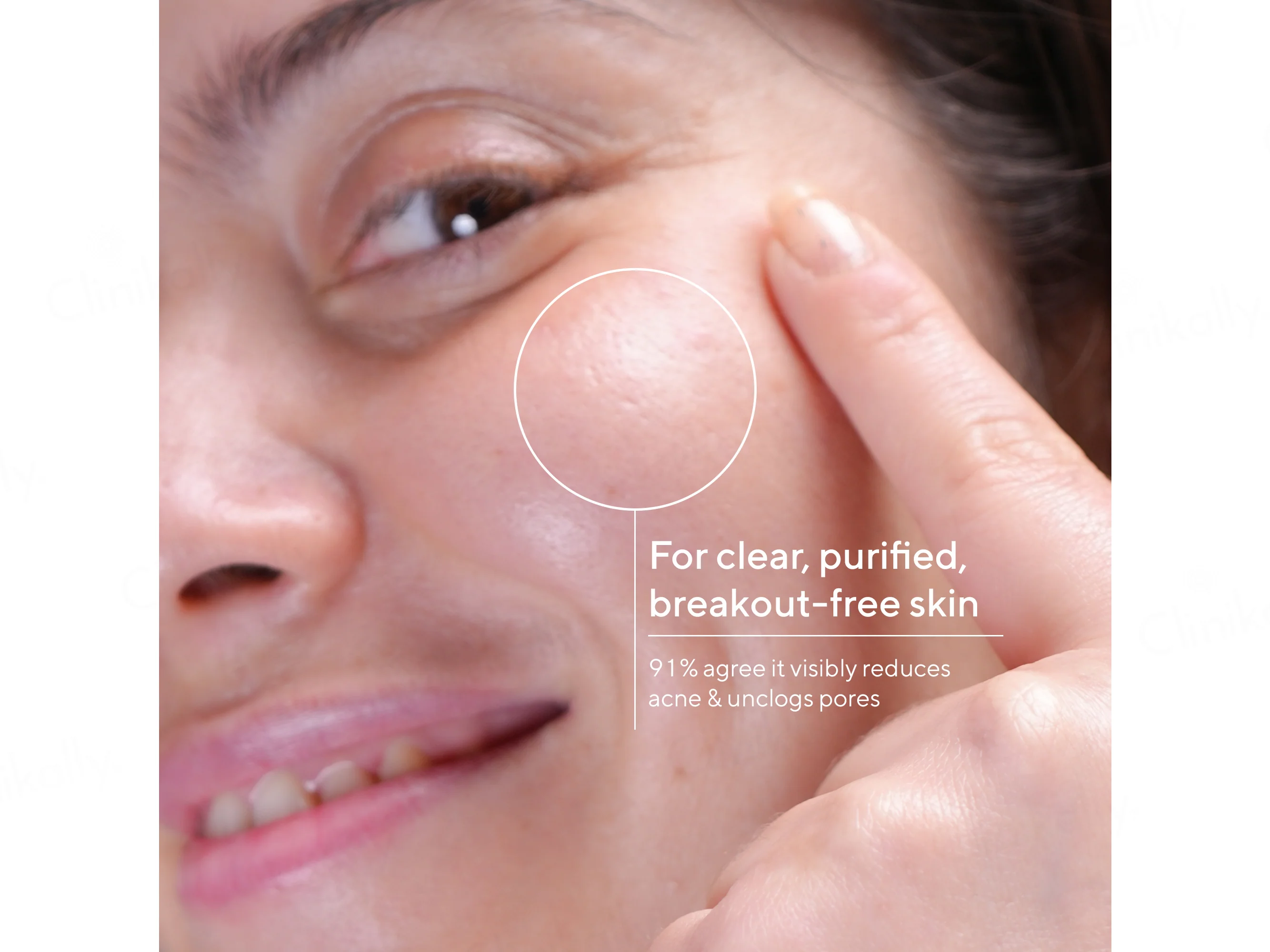 CosiQ FC-3 AHA 10% + BHA 2% Exfoliating Face Cleanser Gel - Image 5