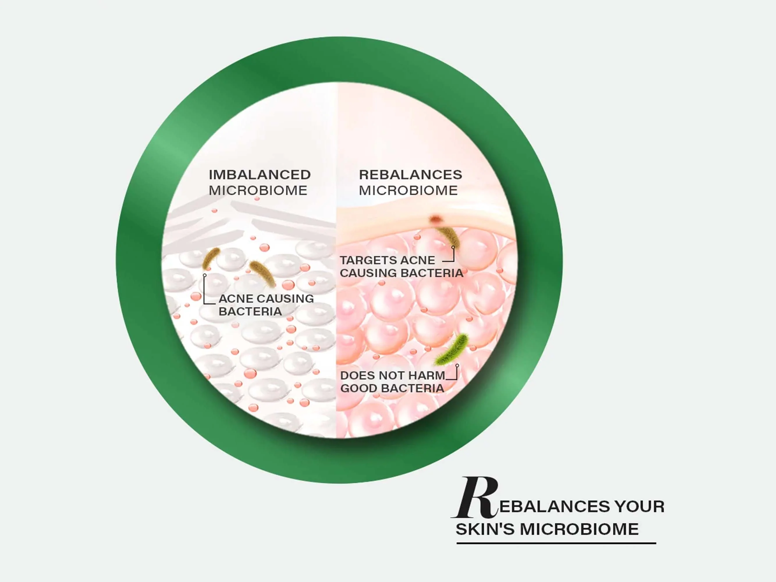 Novology Acne Clearing Serum - Image 7