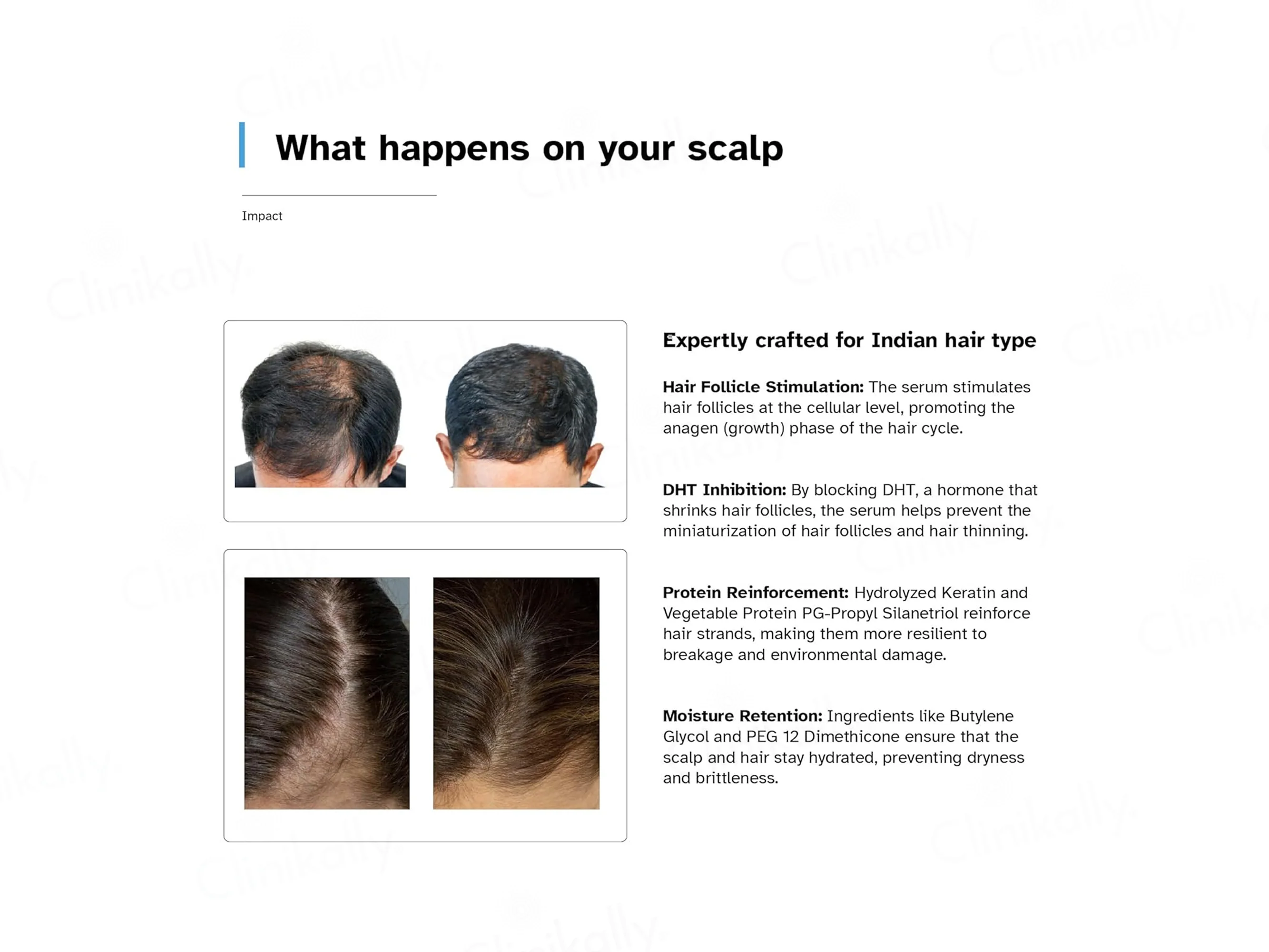 Treatroot Anti-Hair Fall Serum - Image 4